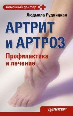 Людмила Рудницкая - Артрит и артроз. Профилактика и лечение